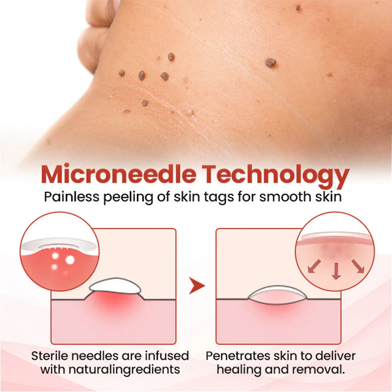 Painless Micro-patch