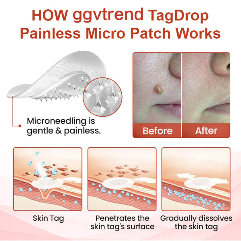 Painless Micro-patch