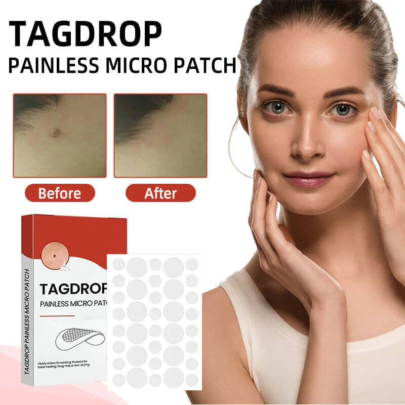 Painless Micro-patch