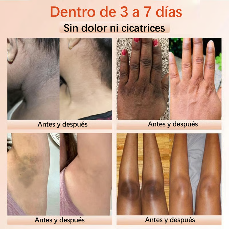 QUARXERY Soft Gel Exfoliator