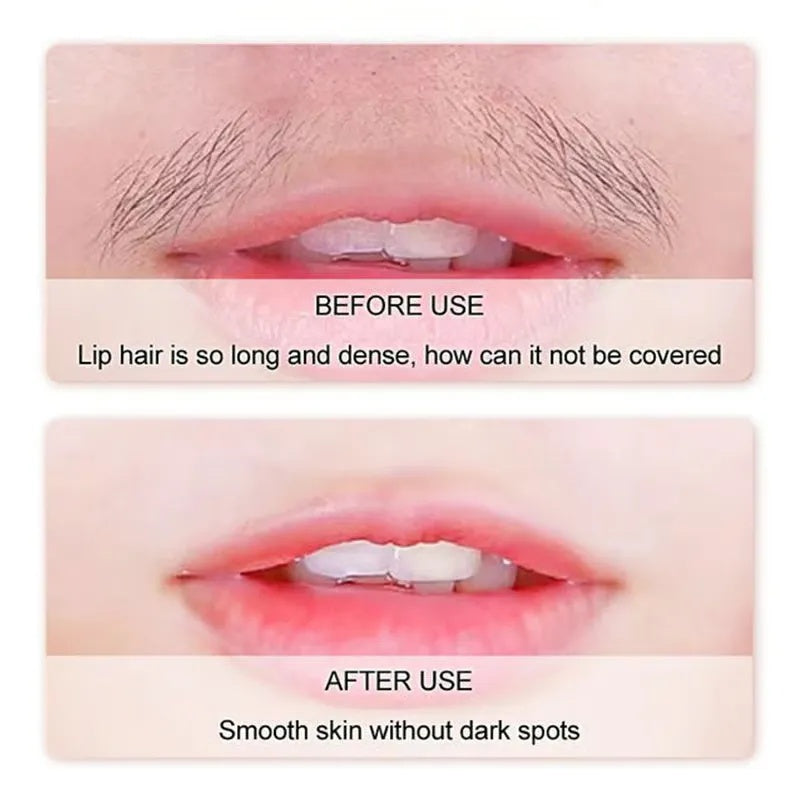 Gentle And Painless Facial Hair Removal Cream