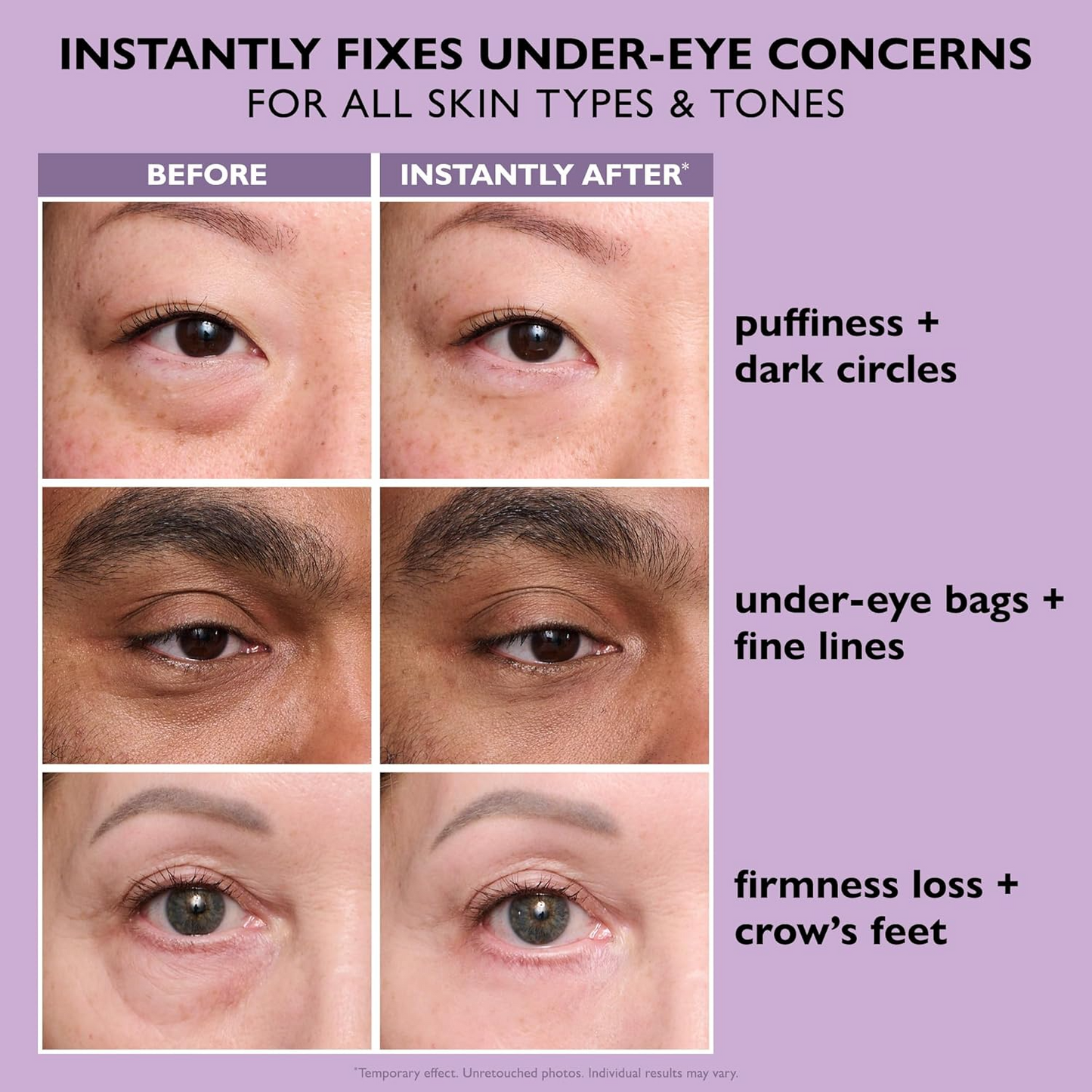 Eye Tightener Easy