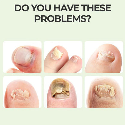 Nail Repair Magic Drops