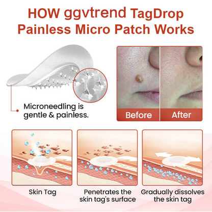 Painless Micro-patch